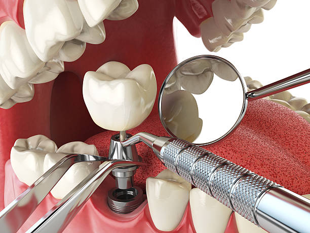 Best Emergency Dental Care for Broken or Chipped Teeth in Erwin, TN